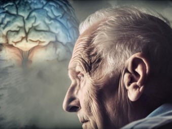 Áttörés az Alzheimer-szűrésben - vérvizsgálat segíti a felismerést